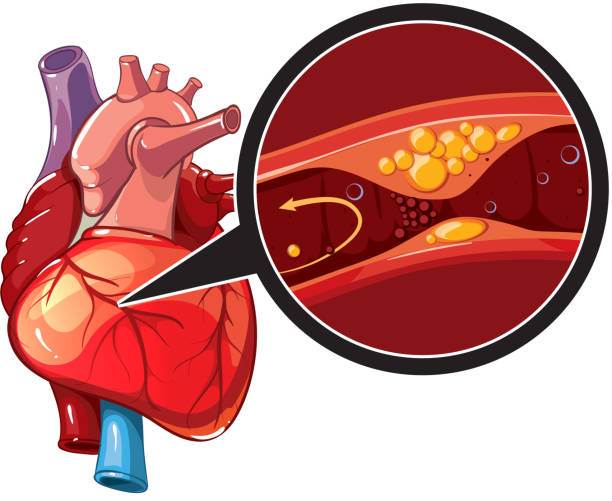 coronary artery disease treatment in shalimar bagh