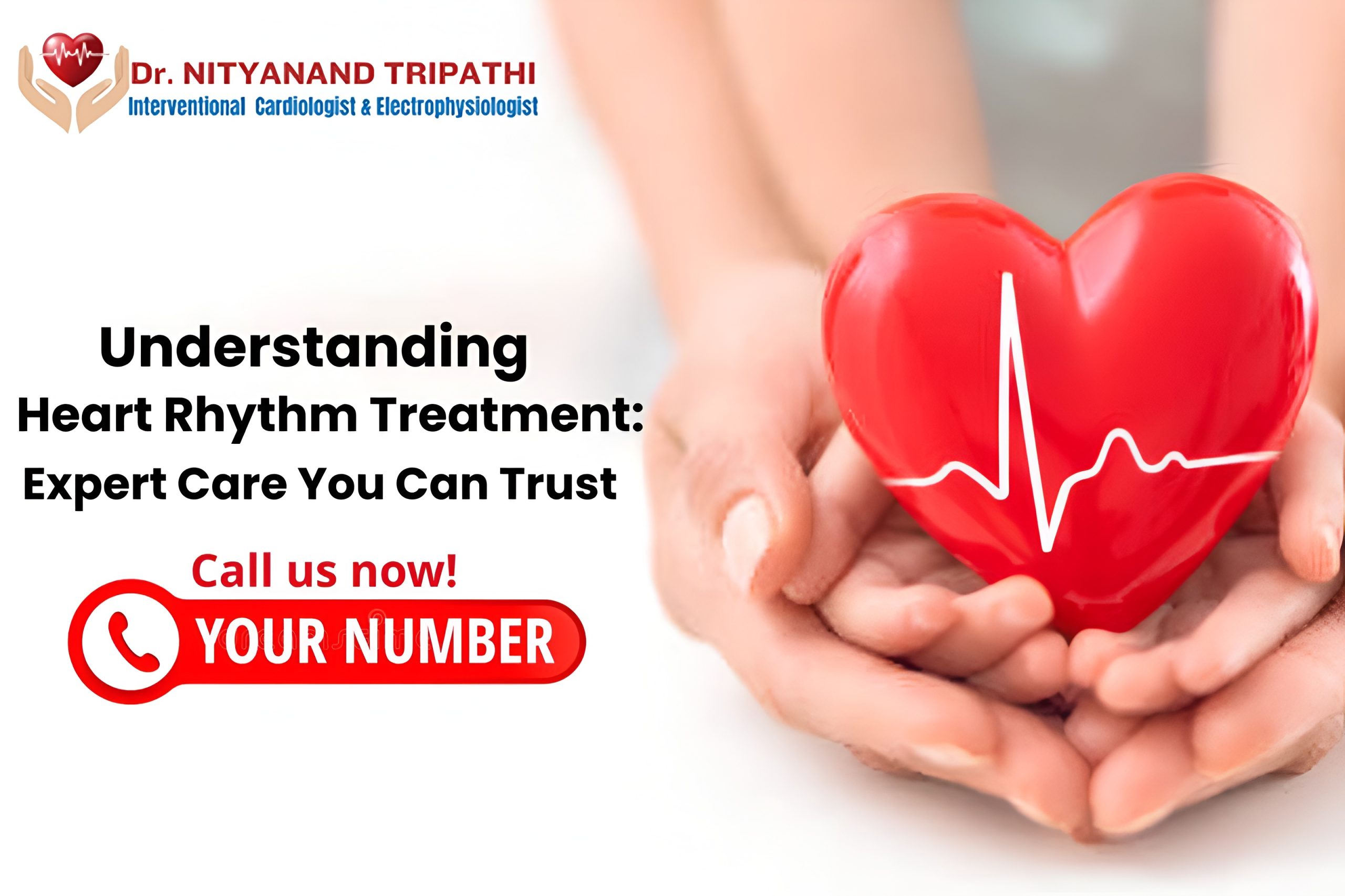 RFA Treatment for Arrhythmia in Shalimar Bagh Delhi