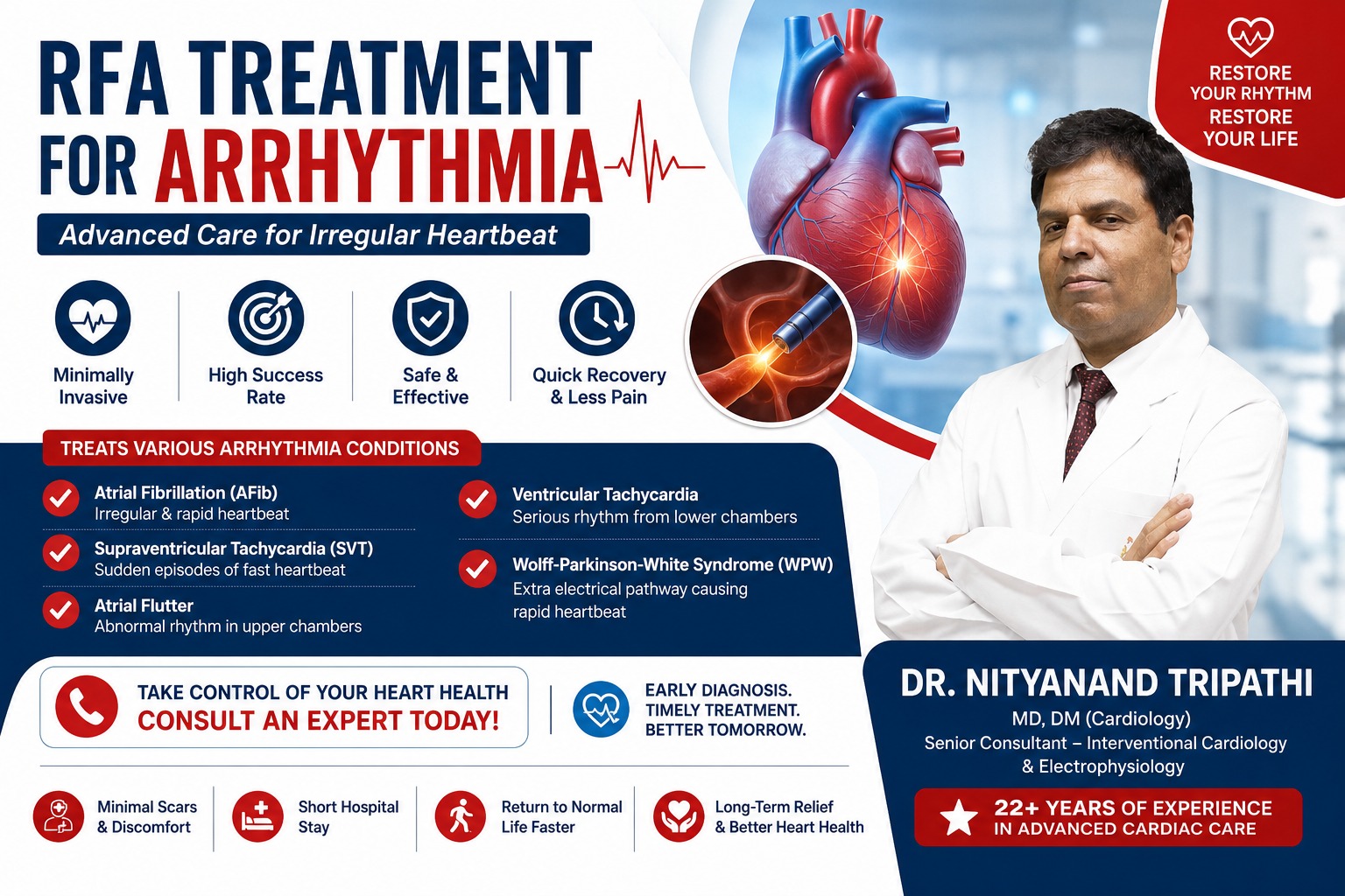 RFA Treatment for Arrhythmia in Shalimar Bagh Delhi