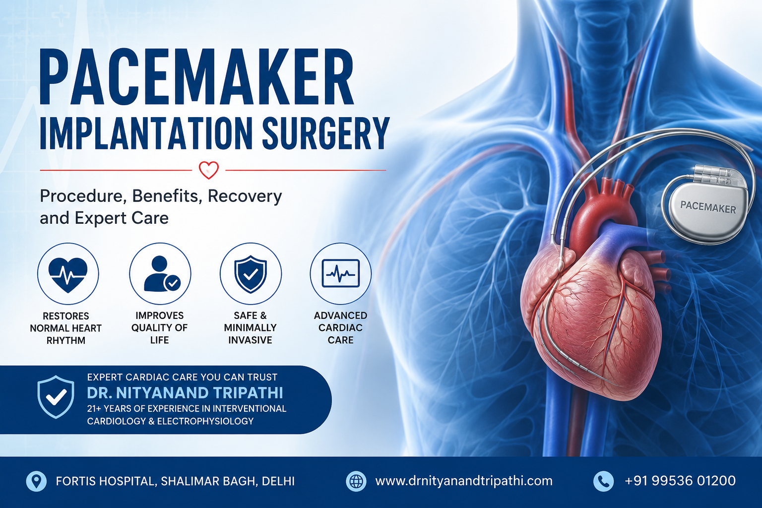 pacemaker implantation surgeon in Delhi