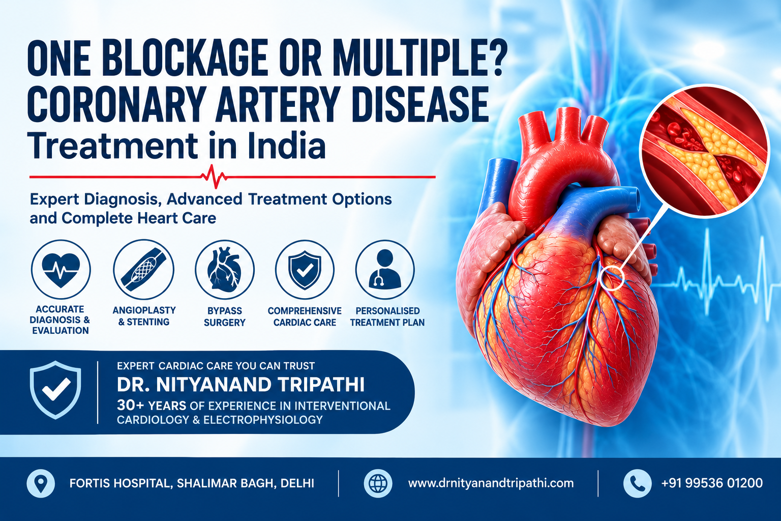 Coronary Artery Disease Treatment in India